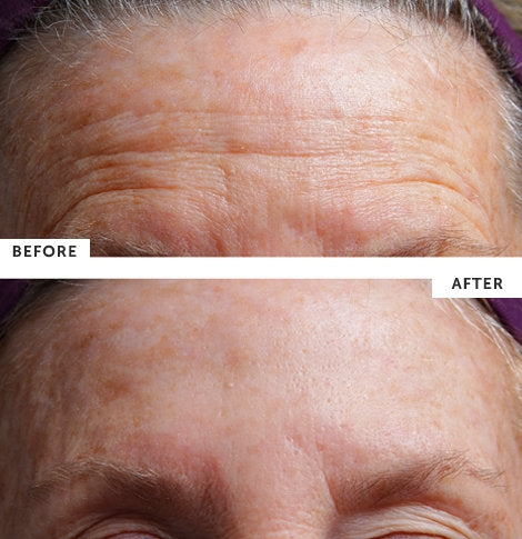 SilcSkin - Facial Pad (Brow Set)