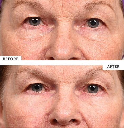 SilcSkin - Eye Pad