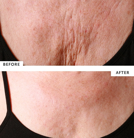 SilcSkin - Decollette Pad