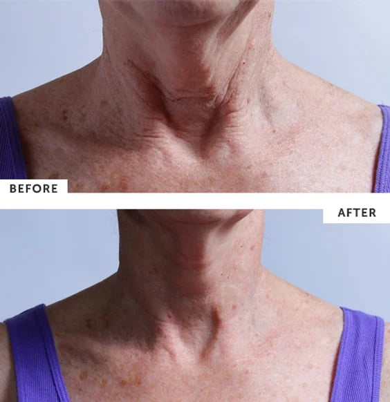 SilcSkin - Collette Pad (for the neck)