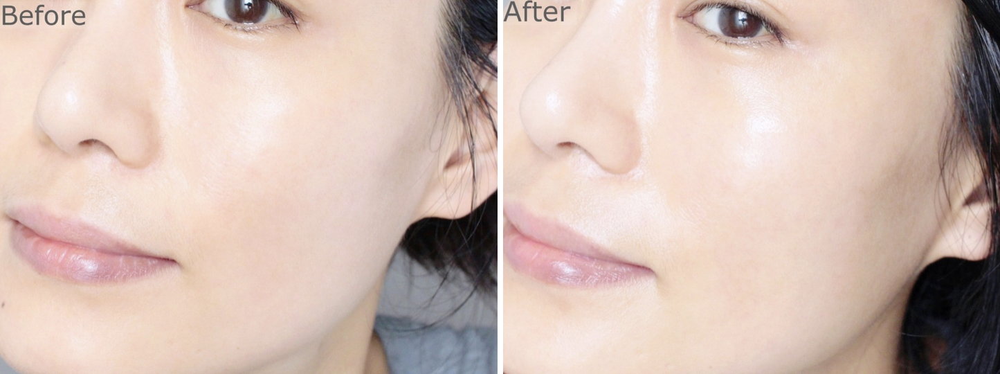Dr. Esthé Azulene Relief Solution Ampoule